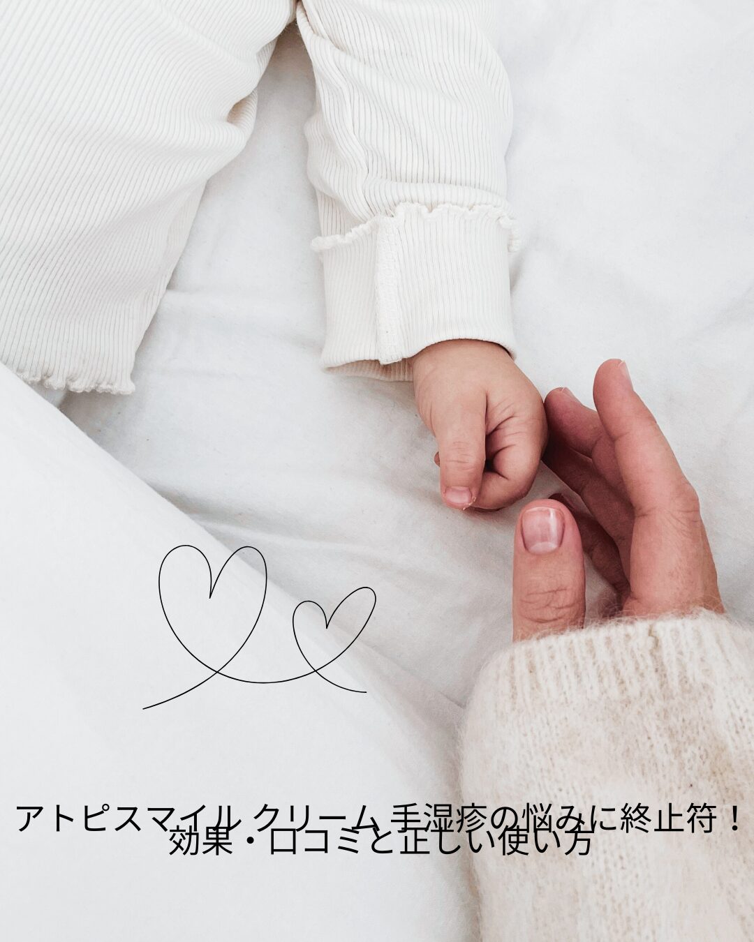 アトピスマイル-クリーム-手湿疹