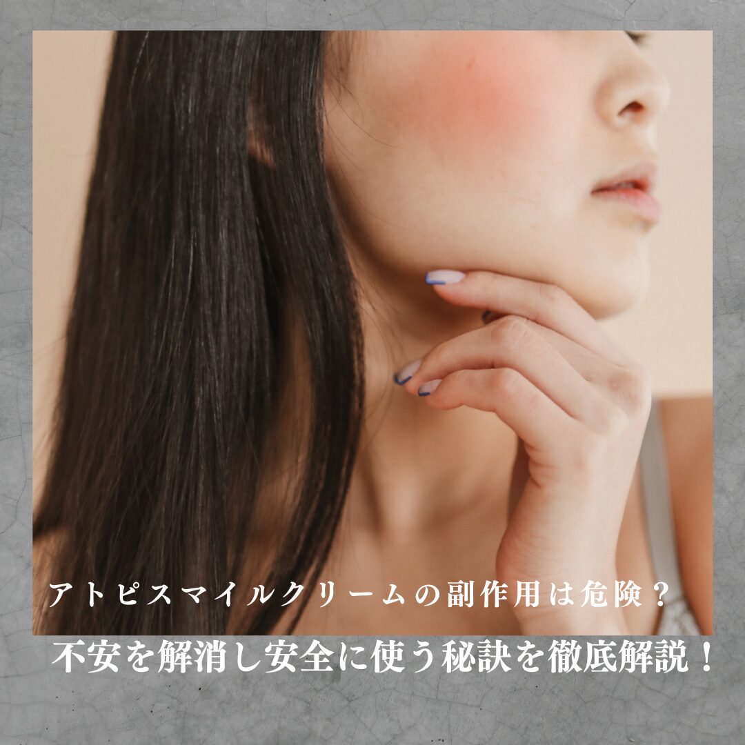 アトピスマイルクリーム 副作用
