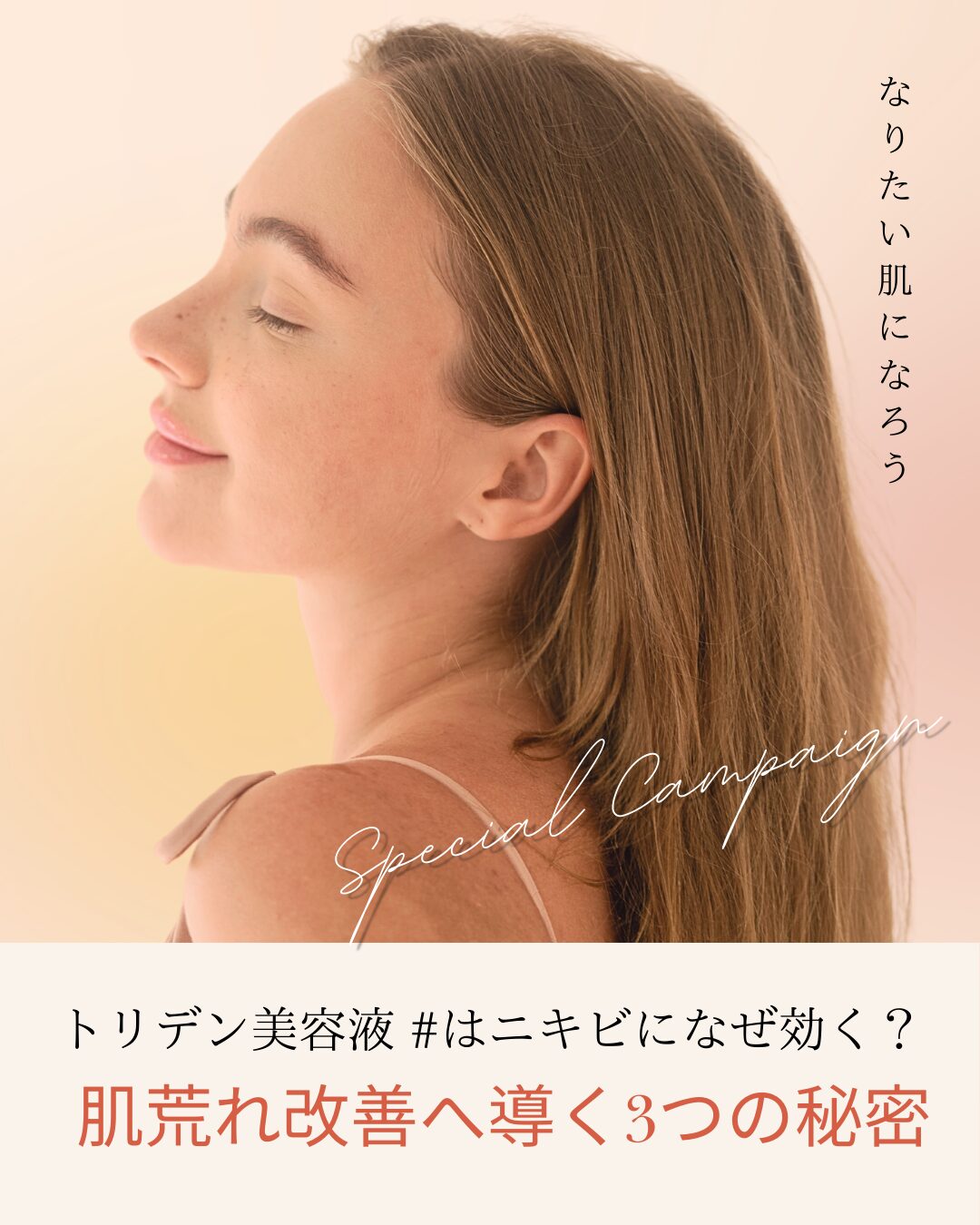 トリデン美容液 ＃ ニキビ